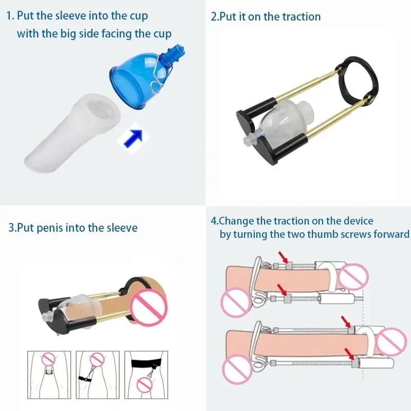 Penis Bending Correct Extender Enlargement with Vacuum Cup Stretcher Traction Exerciser Sex Toys Men Dick Enhancer Bigger Growth